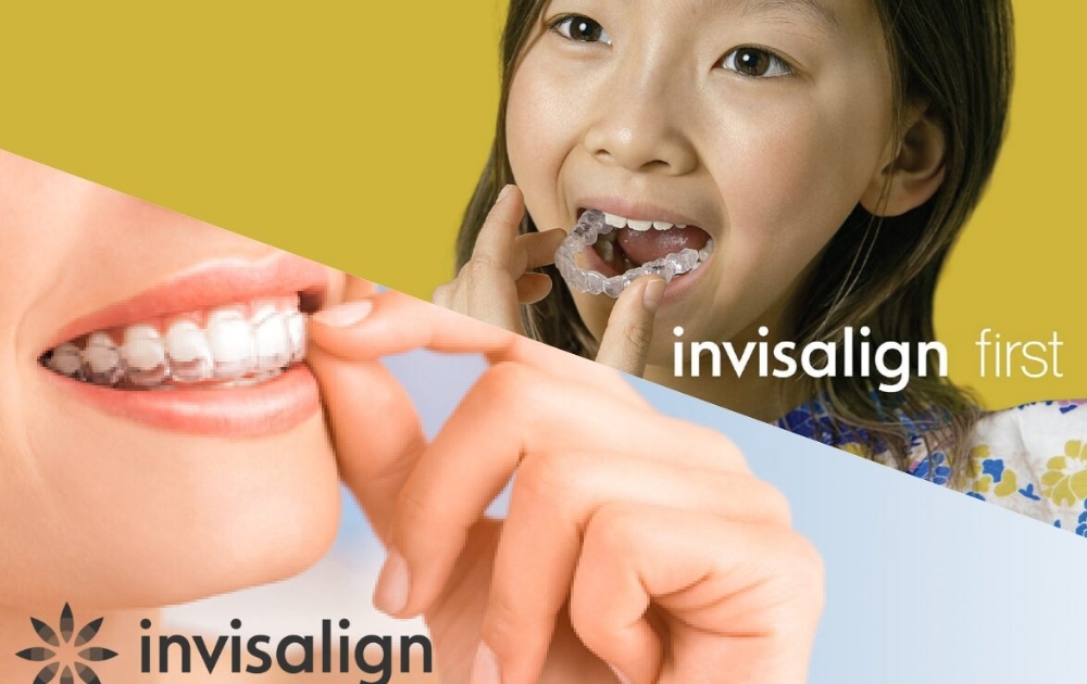 マウスピース矯正を断られた方も