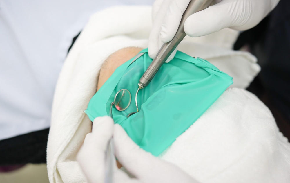 ▼ラバーダムによる感染防止