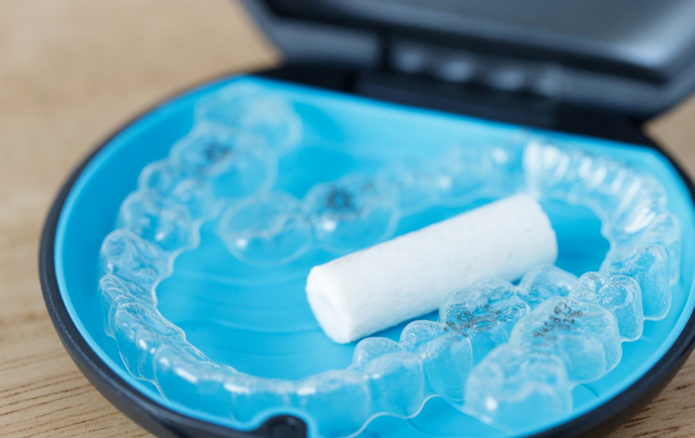 大切なイベントを控えている方へ