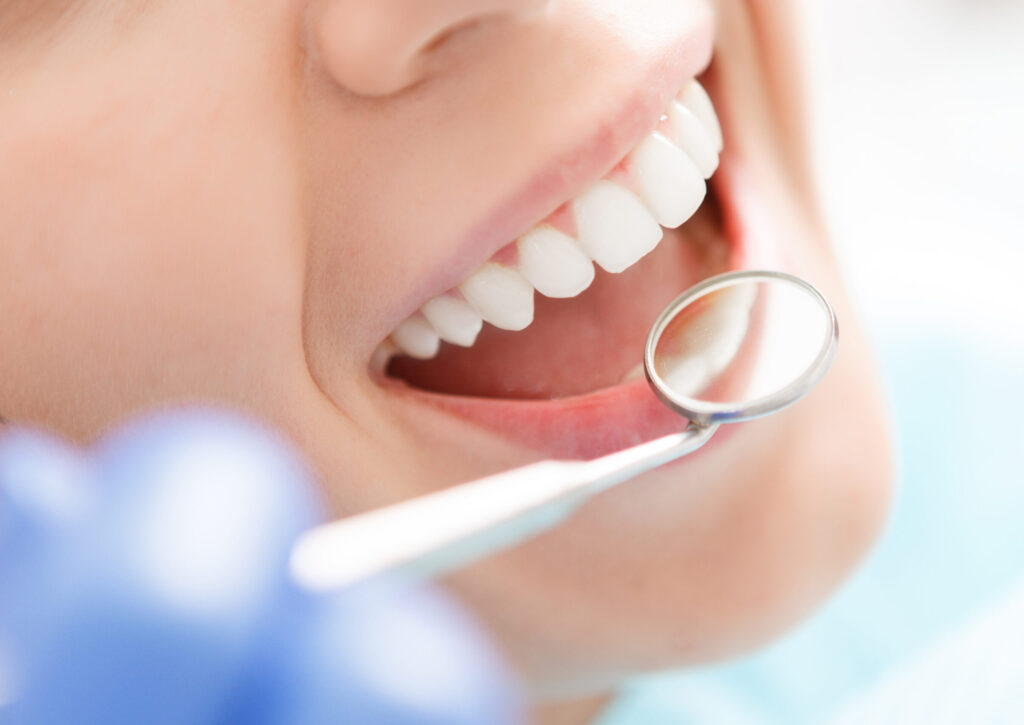 お口の環境を整える歯のクリーニング