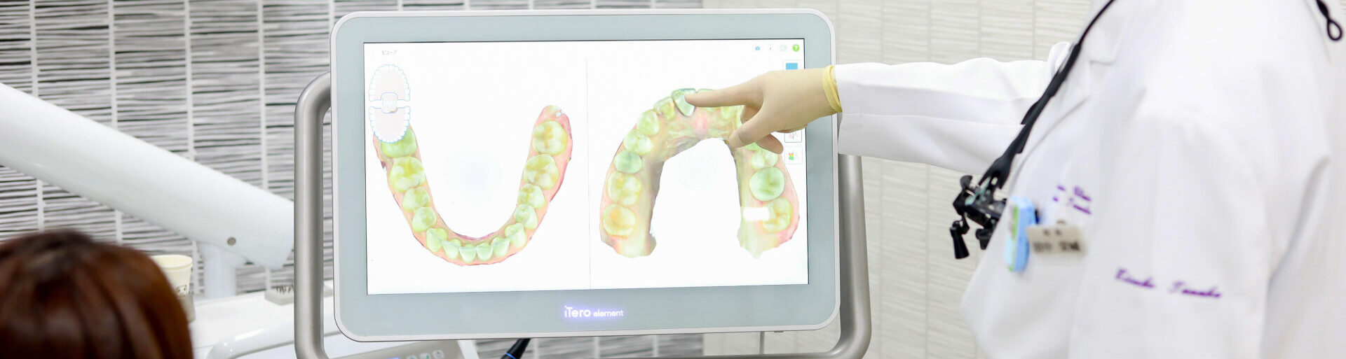 ３Dシミュレーション 治療期間短縮