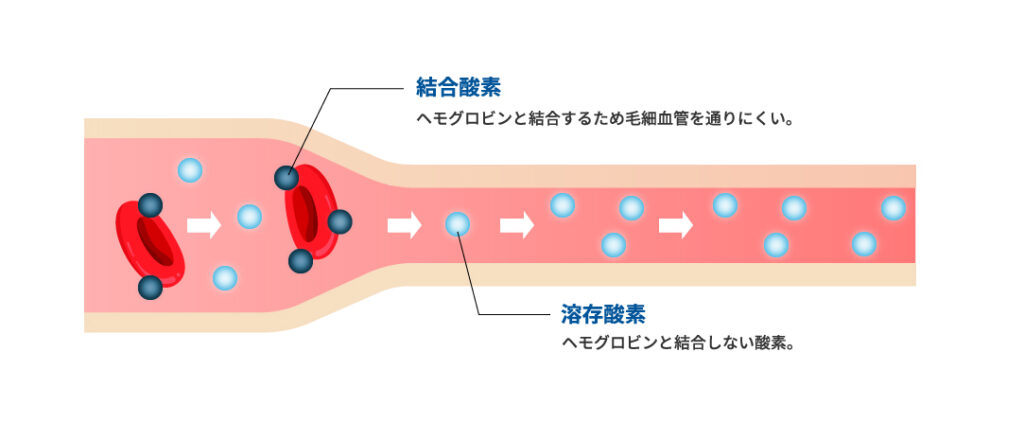 高気圧酸素のチカラ　注１